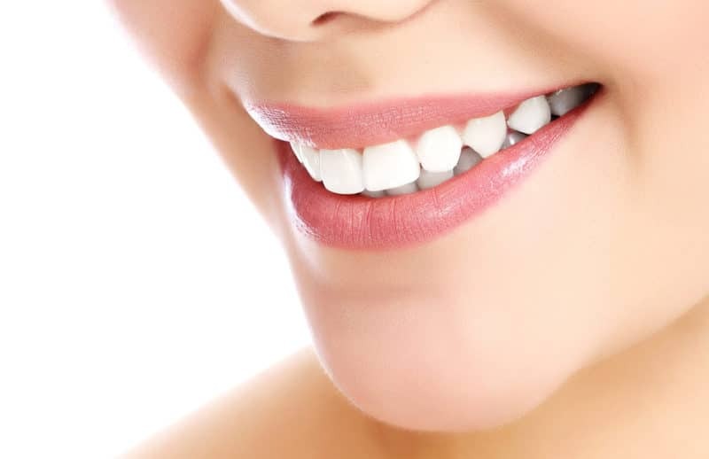 Teeth Whitening Safety Tips